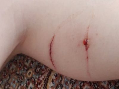 سگ‌هایی که امنیت شهروندان را چنگ می‌زنند، حمله سگ‌  هار به پسر ۱۲ ساله در مرکز شهر تبریز